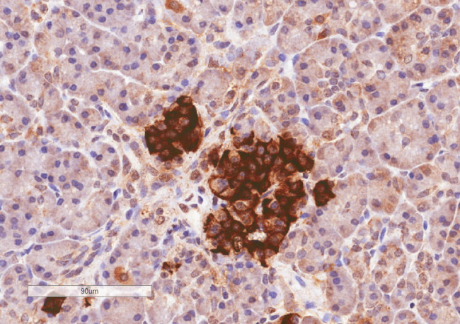 CCKAR Antibody in Immunohistochemistry (Paraffin) (IHC (P))