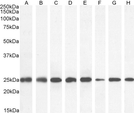 GSTP1 Antibody in Western Blot (WB)