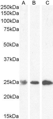 GSTP1 Antibody in Western Blot (WB)