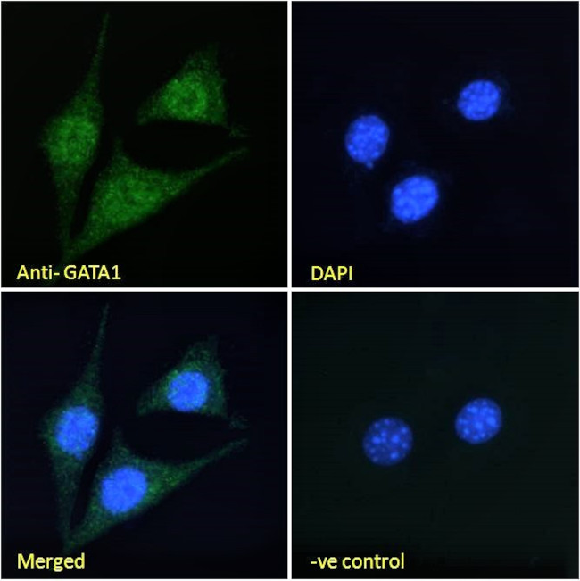 GATA1 Antibody in Immunocytochemistry (ICC/IF)