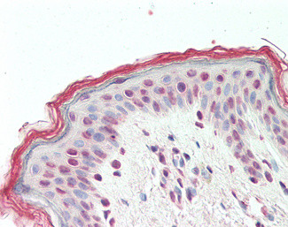 TGIF2 Antibody in Immunohistochemistry (Paraffin) (IHC (P))