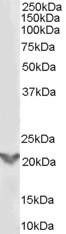 TGIF2 Antibody in Western Blot (WB)