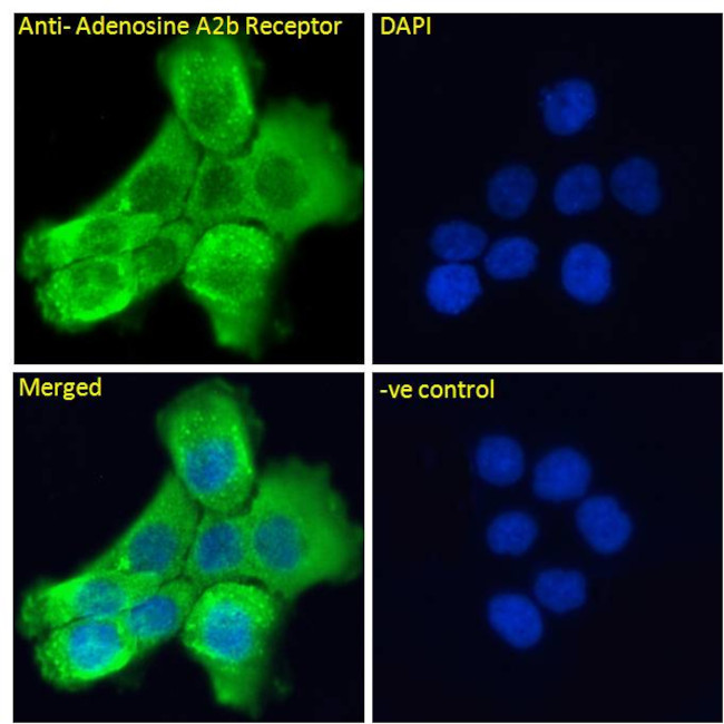 ADORA2B Antibody in Immunocytochemistry (ICC/IF)