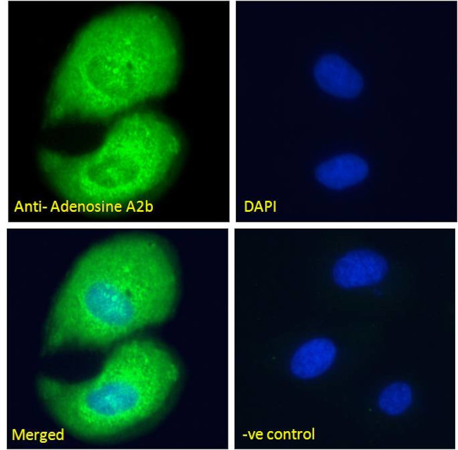 ADORA2B Antibody in Immunocytochemistry (ICC/IF)