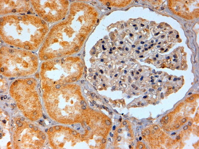 ADORA2B Antibody in Immunohistochemistry (Paraffin) (IHC (P))