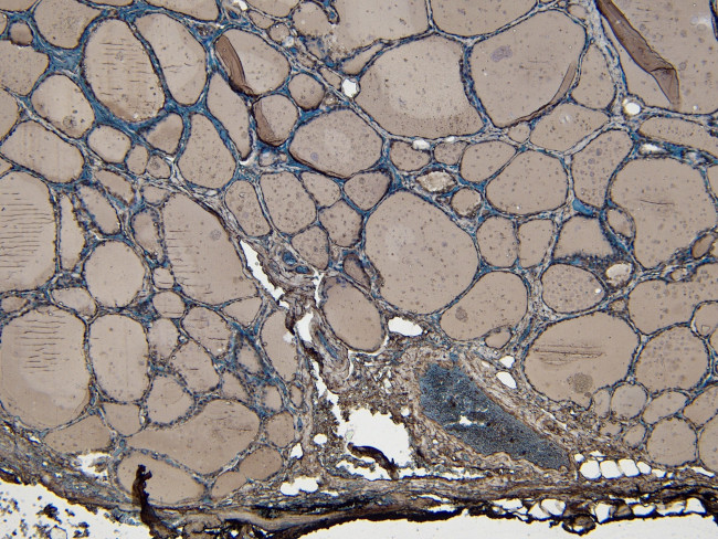 ENPP1 Antibody in Immunohistochemistry (Paraffin) (IHC (P))