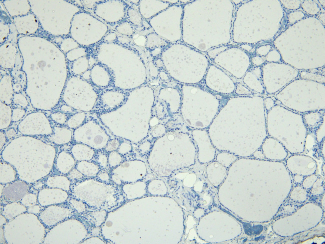 ENPP1 Antibody in Immunohistochemistry (Paraffin) (IHC (P))