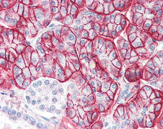 ENPP1 Antibody in Immunohistochemistry (Paraffin) (IHC (P))