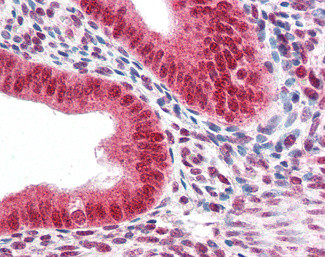 HP1 alpha Antibody in Immunohistochemistry (Paraffin) (IHC (P))