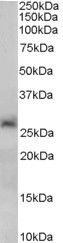 SIRT3 Antibody in Western Blot (WB)