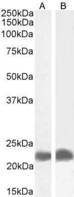 TIRAP Antibody in Western Blot (WB)