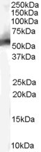 MDM2 Antibody in Western Blot (WB)