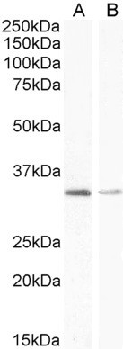 UCP1 Antibody in Western Blot (WB)