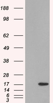 SH2D1A Antibody in Western Blot (WB)