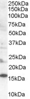 SH2D1A Antibody in Western Blot (WB)