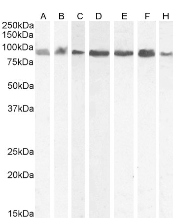 KPNB1 Antibody in Western Blot (WB)