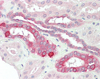 TNFRSF14 Antibody in Immunohistochemistry (Paraffin) (IHC (P))