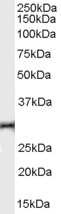 TNFRSF14 Antibody in Western Blot (WB)