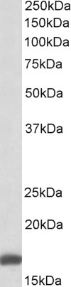 RPS19 Antibody in Western Blot (WB)