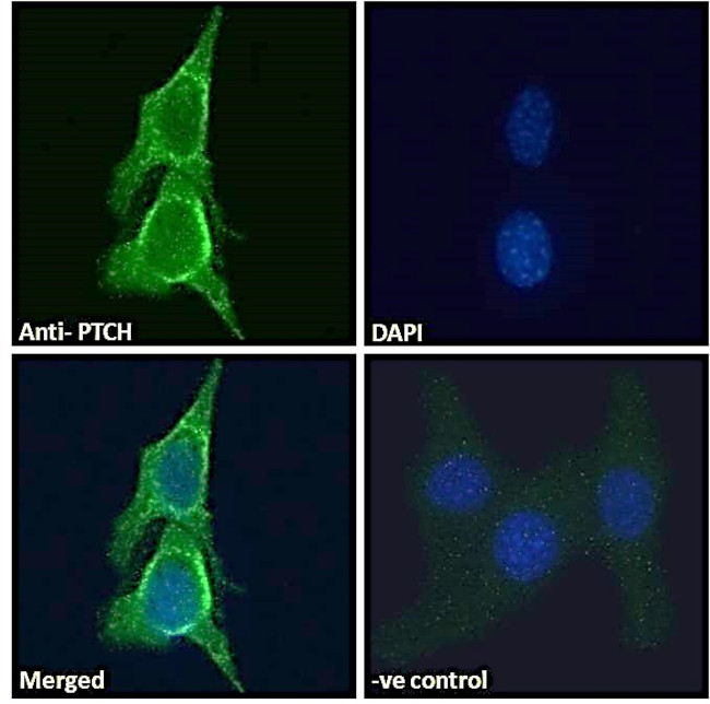 PTCH Antibody in Immunocytochemistry (ICC/IF)