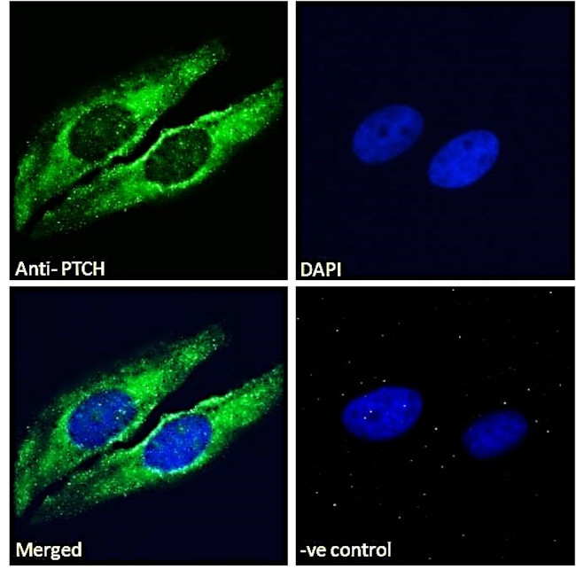 PTCH Antibody in Immunocytochemistry (ICC/IF)