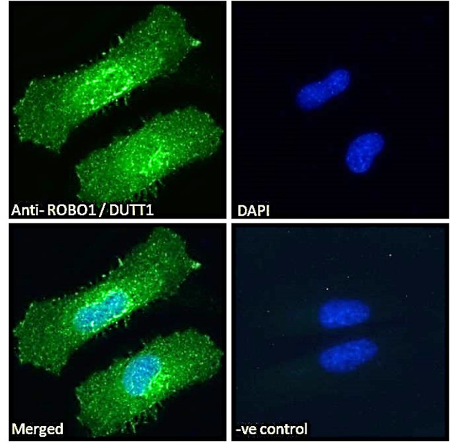 ROBO1 Antibody in Immunocytochemistry (ICC/IF)