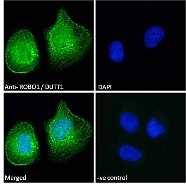 ROBO1 Antibody in Immunocytochemistry (ICC/IF)