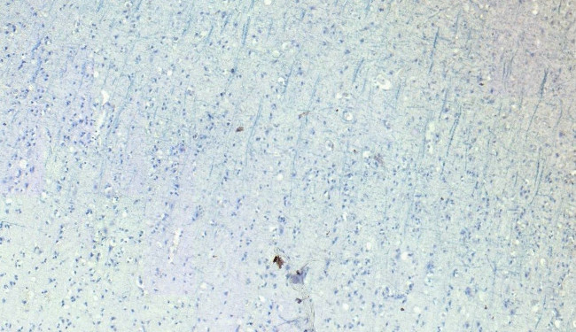 ROBO1 Antibody in Immunohistochemistry (Paraffin) (IHC (P))