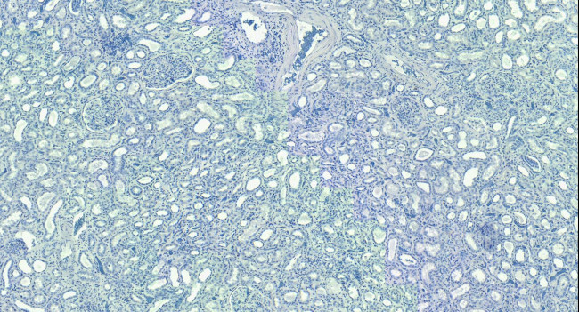 ROBO1 Antibody in Immunohistochemistry (Paraffin) (IHC (P))