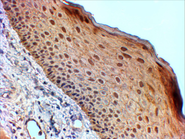 14-3-3 sigma Antibody in Immunohistochemistry (Paraffin) (IHC (P))