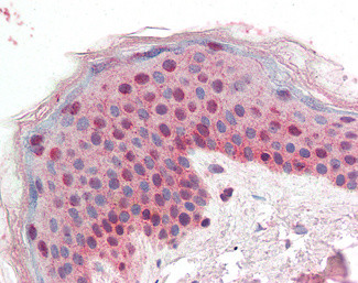 14-3-3 sigma Antibody in Immunohistochemistry (Paraffin) (IHC (P))