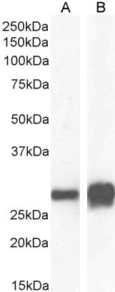 14-3-3 sigma Antibody in Western Blot (WB)