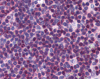 p27 Kip1 Antibody in Immunohistochemistry (Paraffin) (IHC (P))