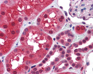 TRAF2 Antibody in Immunohistochemistry (Paraffin) (IHC (P))