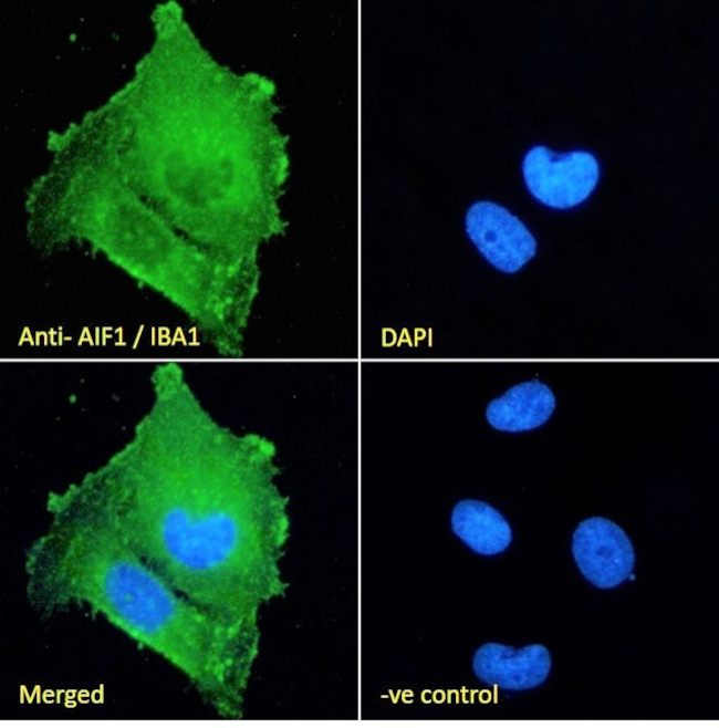 IBA1 Antibody in Immunocytochemistry (ICC/IF)