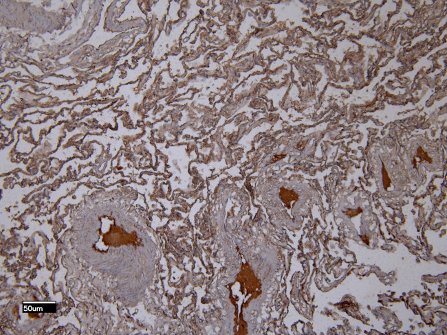 IBA1 Antibody in Immunohistochemistry (Paraffin) (IHC (P))