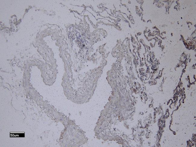 IBA1 Antibody in Immunohistochemistry (Paraffin) (IHC (P))