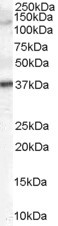 GALR3 Antibody in Western Blot (WB)