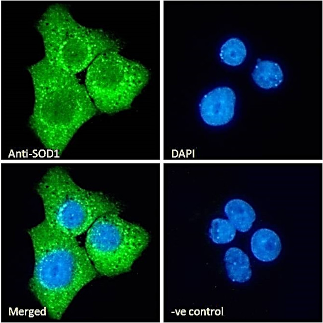 SOD1 Antibody in Immunocytochemistry (ICC/IF)