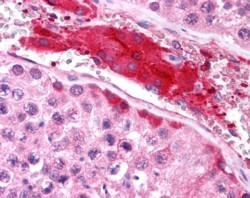 HGS Antibody in Immunohistochemistry (Paraffin) (IHC (P))