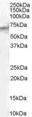 STAM2 Antibody in Western Blot (WB)