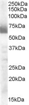 CYP17A1 Antibody in Western Blot (WB)