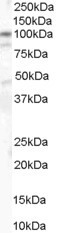 Catenin alpha-1 Antibody in Western Blot (WB)