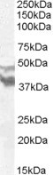 DYX1C1 Antibody in Western Blot (WB)