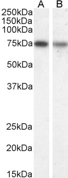 ChAT Antibody in Western Blot (WB)