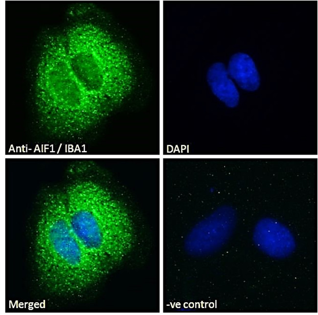 IBA1 Antibody in Immunocytochemistry (ICC/IF)