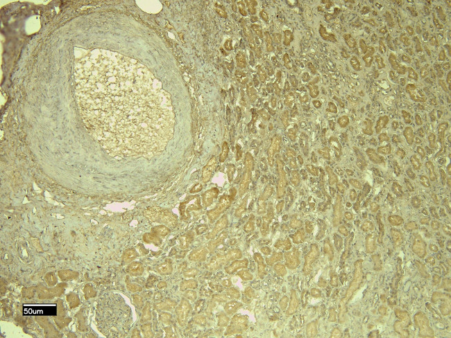 Leptin Receptor Antibody in Immunohistochemistry (Paraffin) (IHC (P))