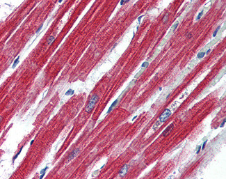 Leptin Receptor Antibody in Immunohistochemistry (Paraffin) (IHC (P))