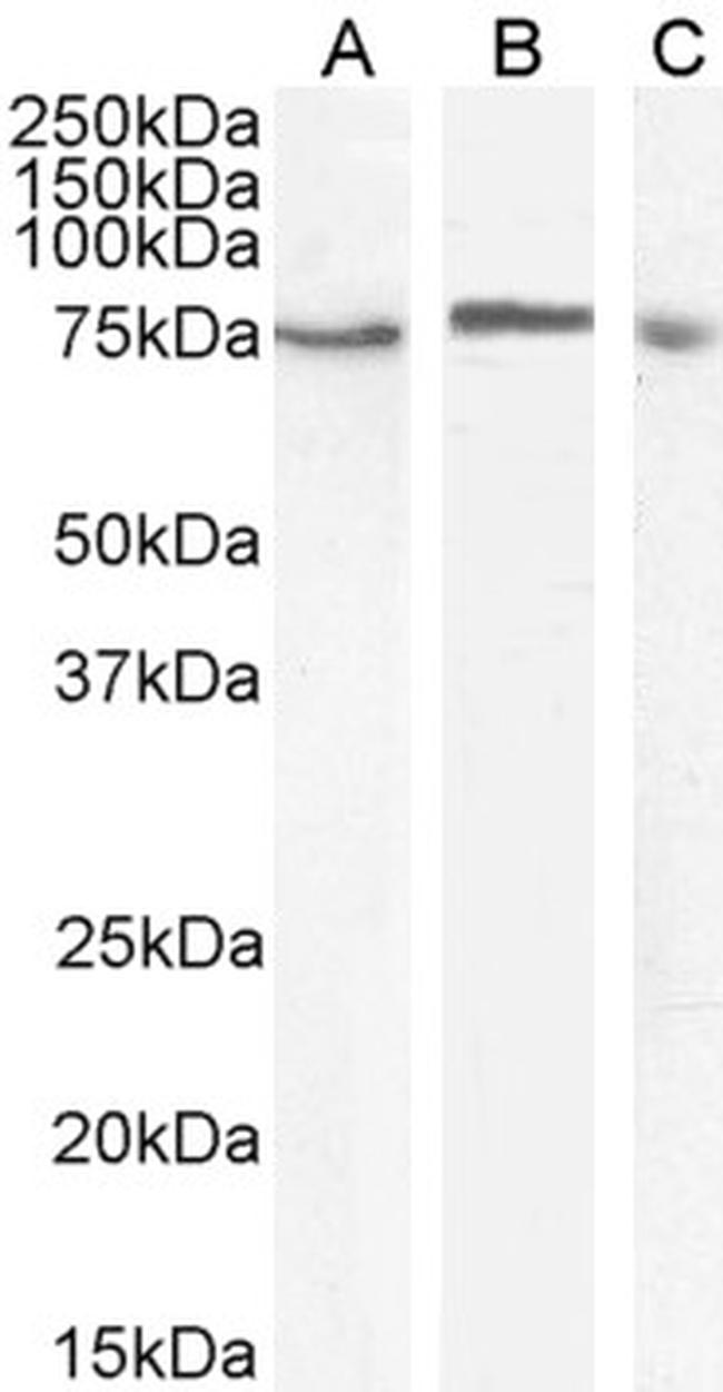 TAK1 Antibody in Western Blot (WB)