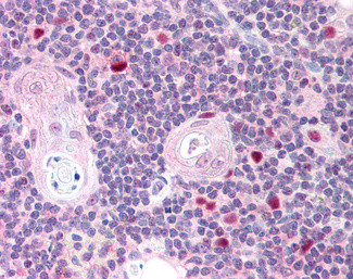 AIRE Antibody in Immunohistochemistry (Paraffin) (IHC (P))